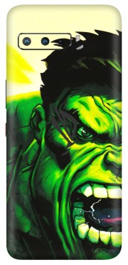 ASUS Phone Skins (All Models) - Hulk - 3D Embossed Finish (L-180) Asus ROG Phone 3