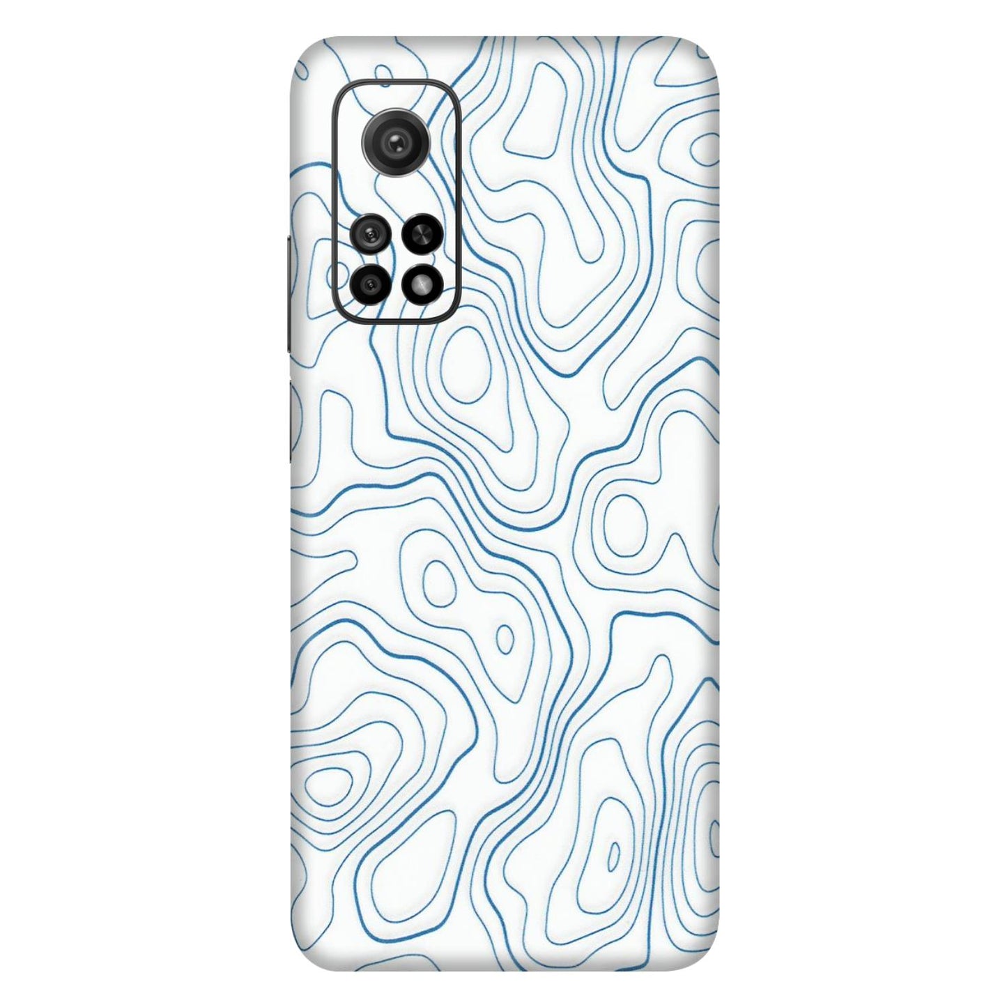 Xiaomi Redmi Phone Skins (All Models) - Blue And White Swirls - Matte Finish (M-139) Mi 10T 5G