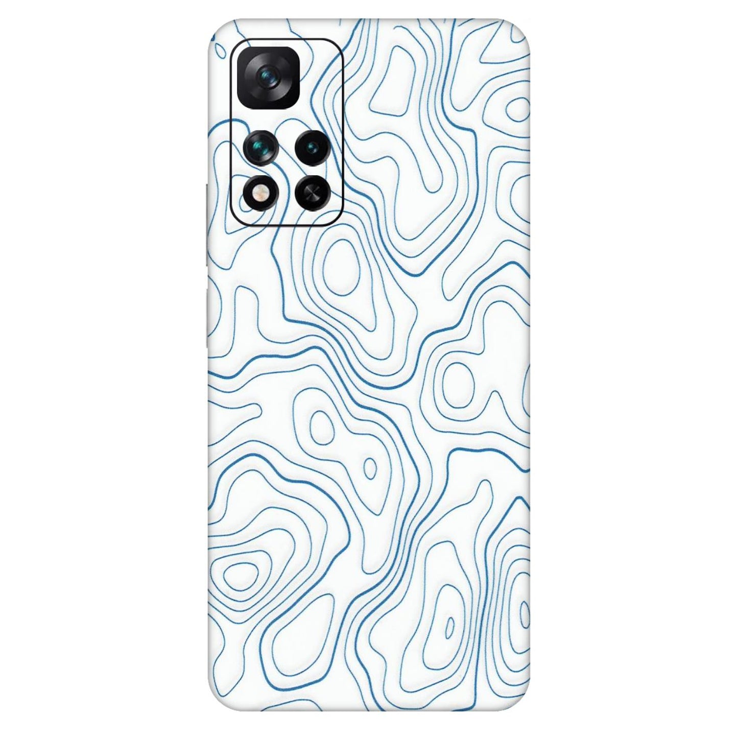 Xiaomi Redmi Phone Skins (All Models) - Blue And White Swirls - Matte Finish (M-139) Mi 11i 5G