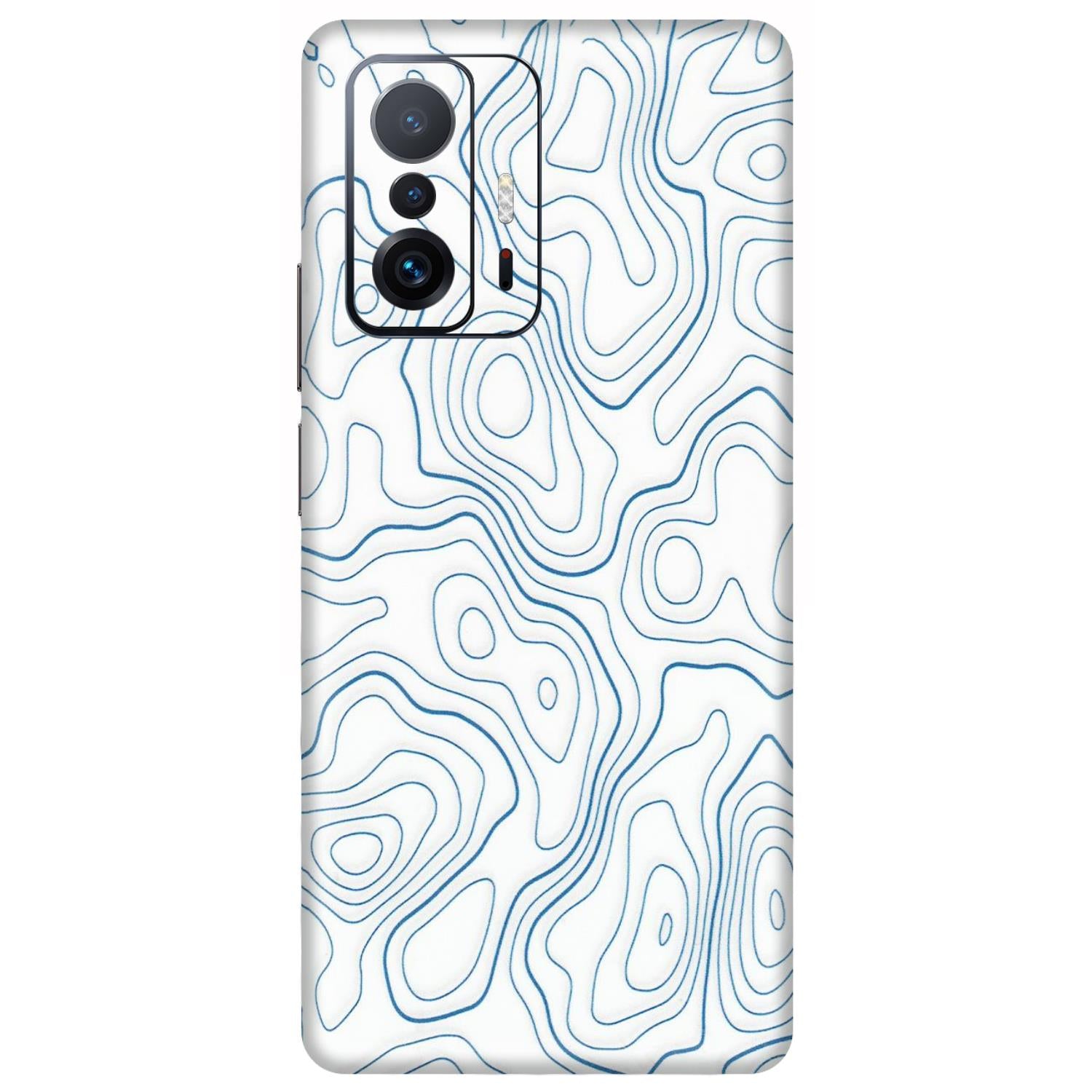 Xiaomi Redmi Phone Skins (All Models) - Blue And White Swirls - Matte Finish (M-139) Mi 11 T Pro
